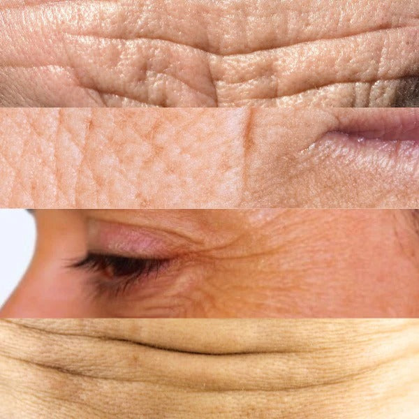 ANTI-AGING